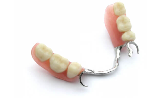 Removable dentures at Karina Mattaliano & Associates Dental Clinic